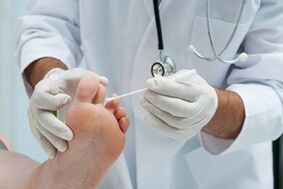 Before treatment, the doctor diagnoses onychomycosis. 